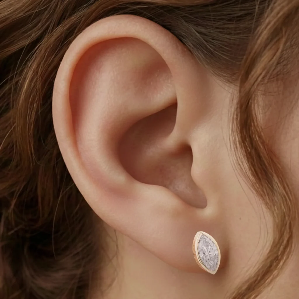 1 Standard Lobe
