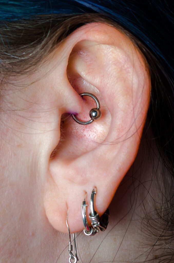 A woman's ear showing recent Daith Piercing