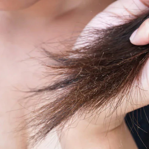 SLMD Blog Dr. Pimple Popper Explains What Causes Split Ends