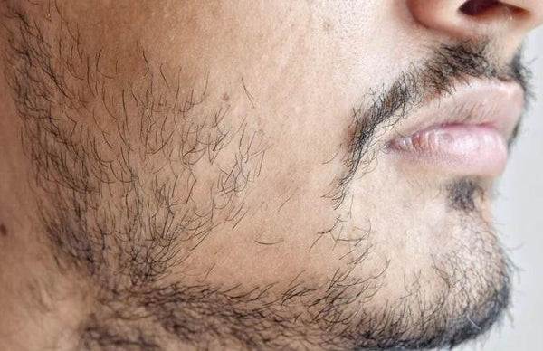 Why Can t I Grow a Beard 600x600