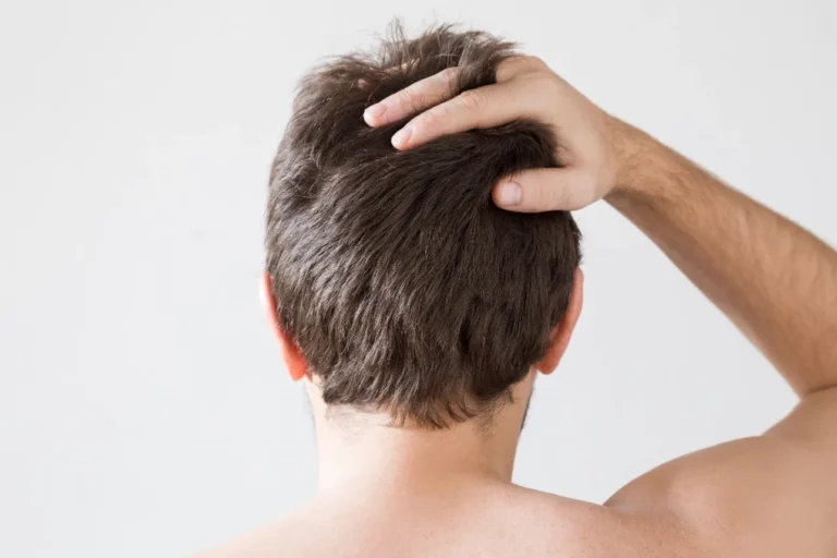 dry and damage hair care for men