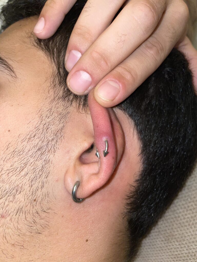 i-need-help-i-think-my-piercing-is-done-wrong-v0-tnkqxjqt0upb1