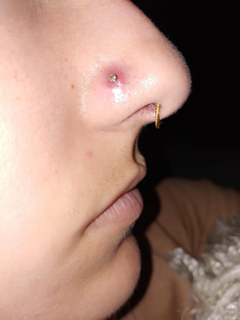 very-red-around-piercing-v0-84p62dhzga891