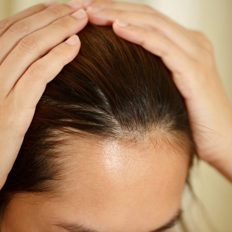 woman-has-problems-with-hair-and-scalp-royalty-free-image-1708634175