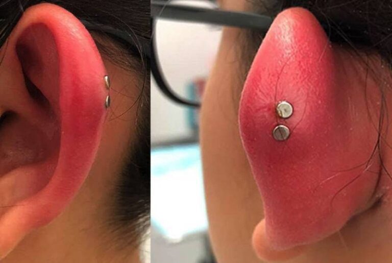 ear-piercing-swelling