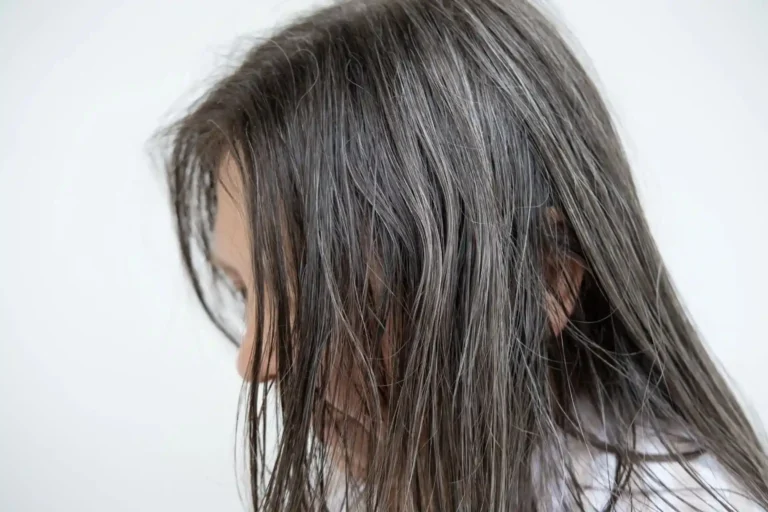oily-hair