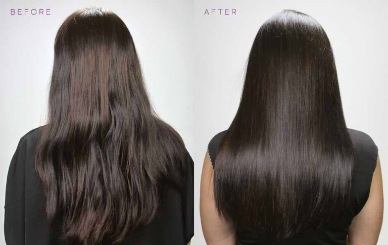 Irena-BeforeAfter-Sides-592x938
