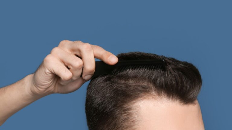 Non-Surgical+Hair+Regrowth